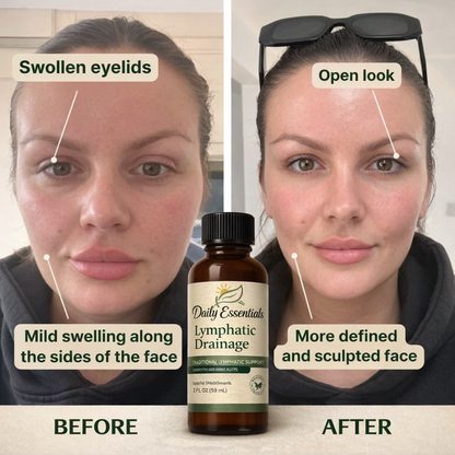 Lymphatic Drainage Herbal Drops